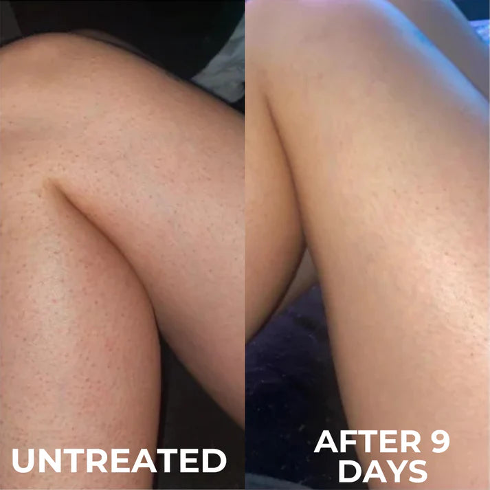 Strawberry Skin Smoother