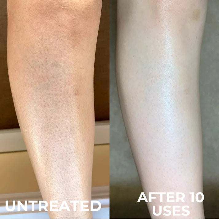 Strawberry Skin Smoother